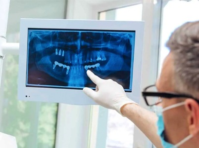Dentist pointing at x-ray