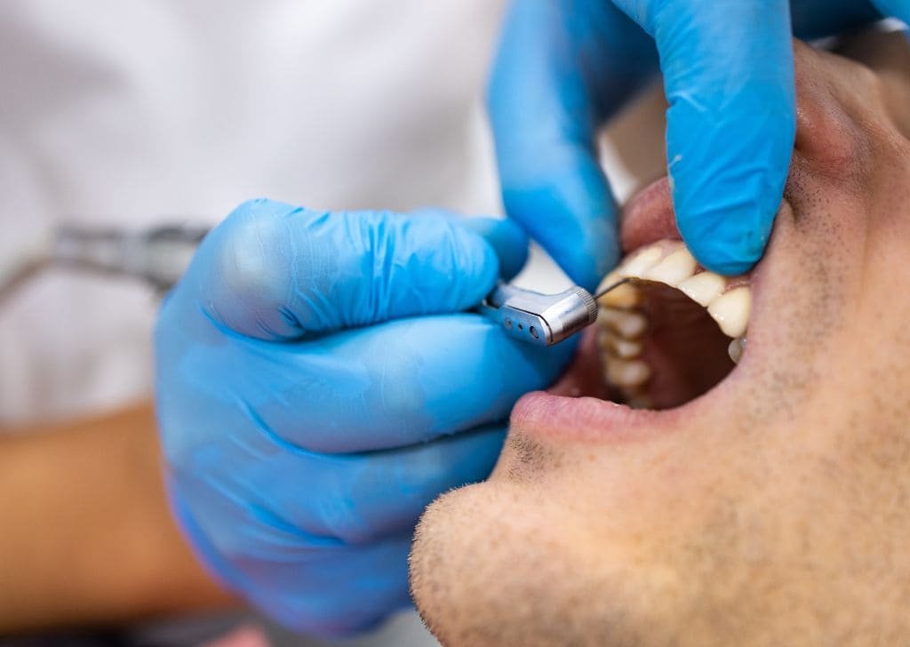 Dentist performing an emergency treatment at an emergency dentist in Ipswich.
